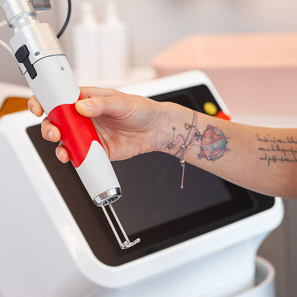 Eine Hand hält ein Lasergerät zur Tattooentfernung. Der Unterarm ist tätowiert.