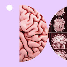 Collage mit Gehirnbildern