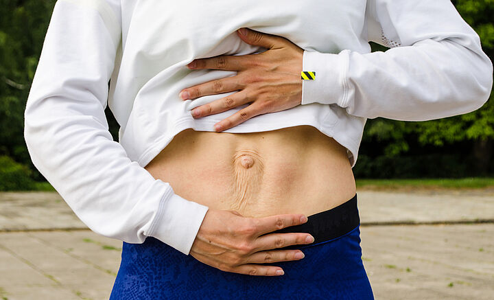 Eine Person hebt ihr weißes Hemd und zeigt ihren Bauch, der Narben rund um den Bauchnabel aufweist.